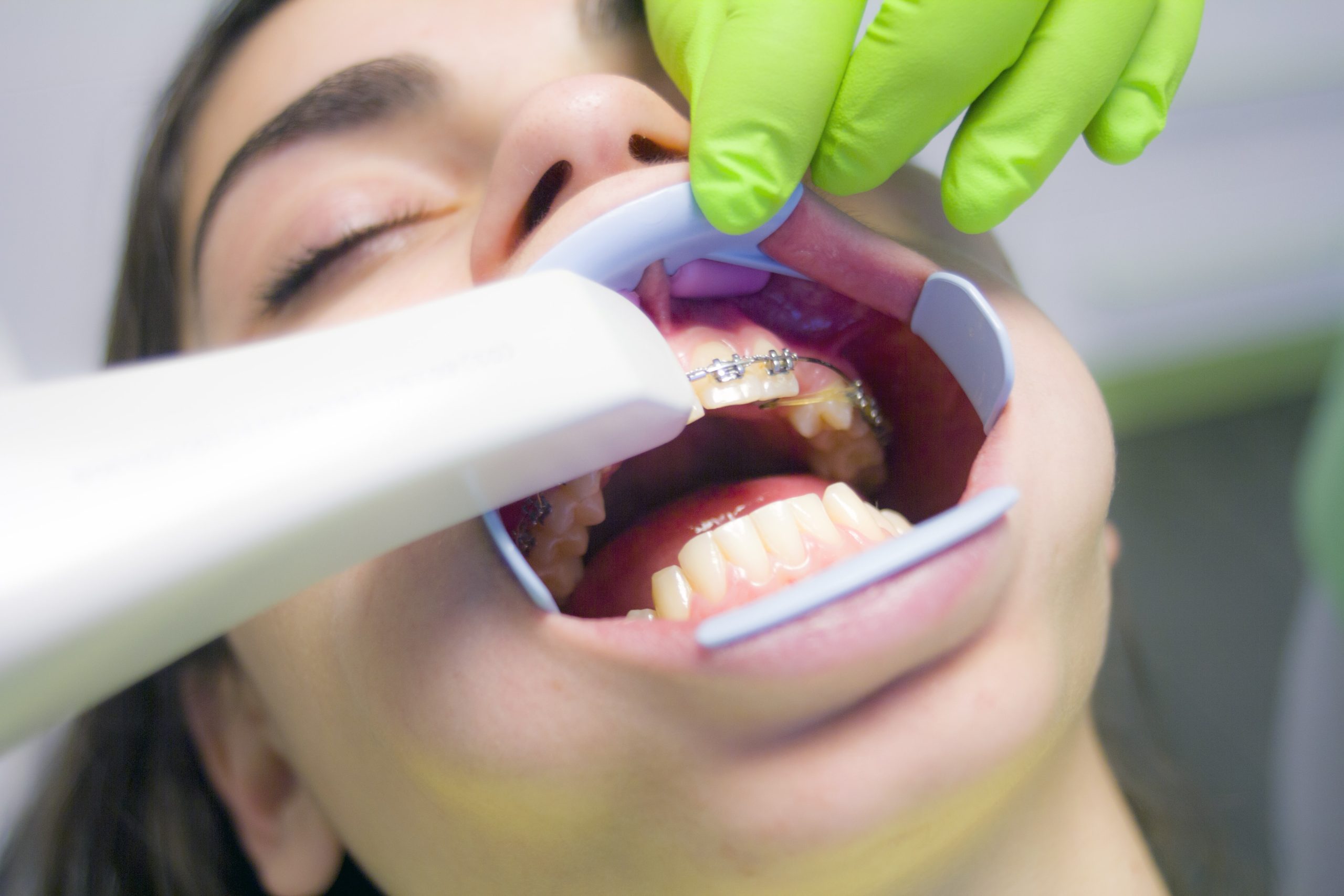 advanced dental technology at Future of Dentistry in Billerica and Chelmsford, MA
