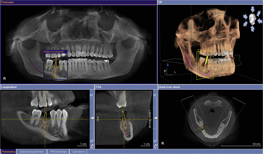 panoramic x-rays used at Future of Dentistry in Billerica, Wakefield, Dracut, North Andover, and Chelmsford, MA