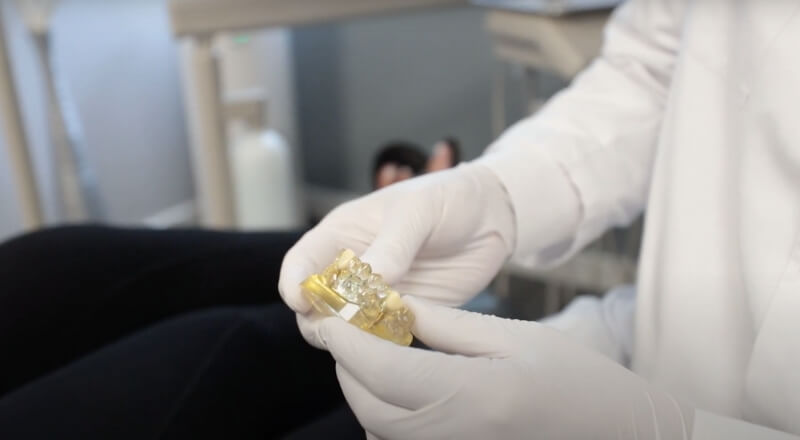 Dental Implants in Billerica, Chelmsford, Wakefield, MA