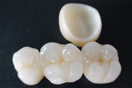 ceramic same day crowns in Billerica, MA