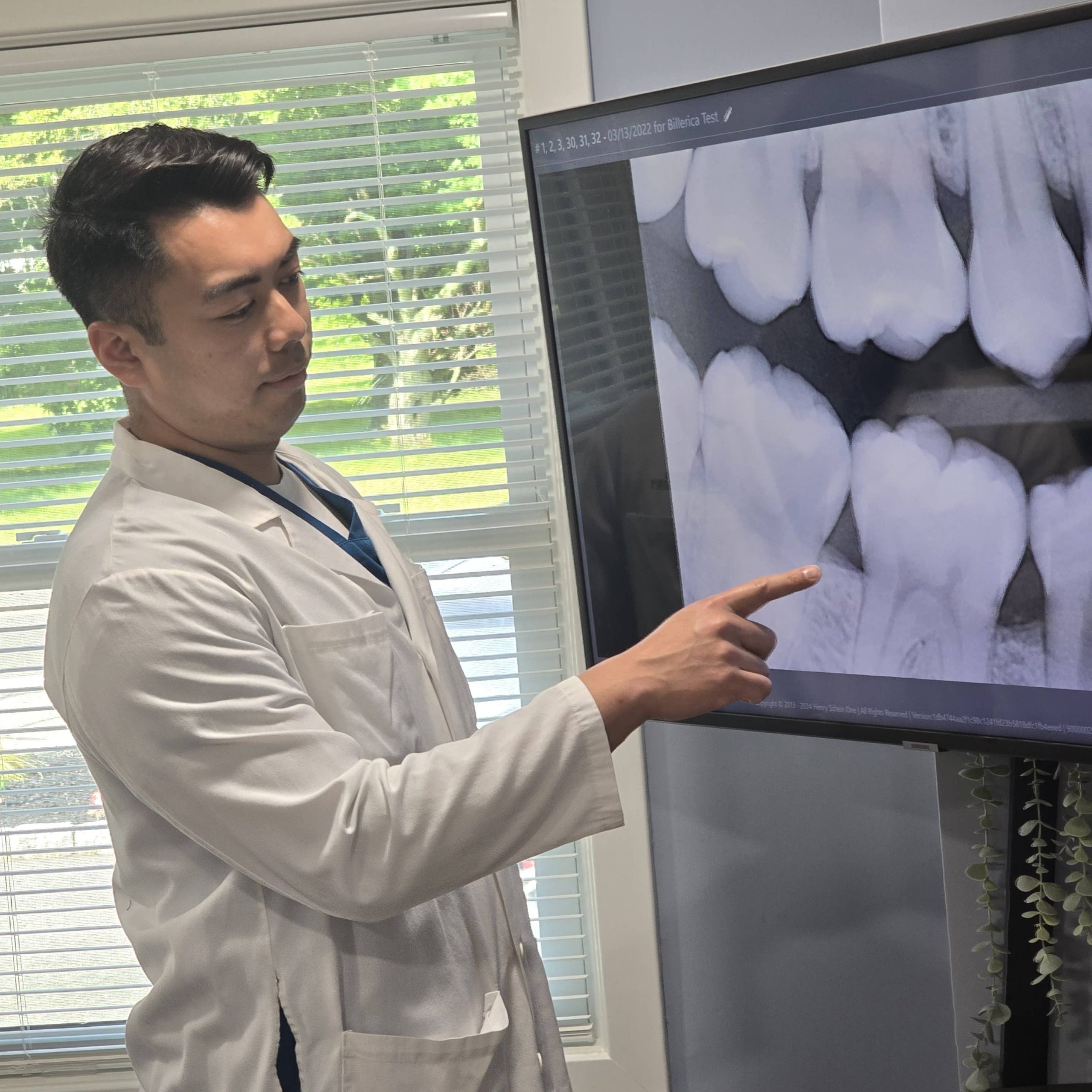 porcelain dental veneers in Billerica, North Billerica, Tewksbury, and Wilmington, MA