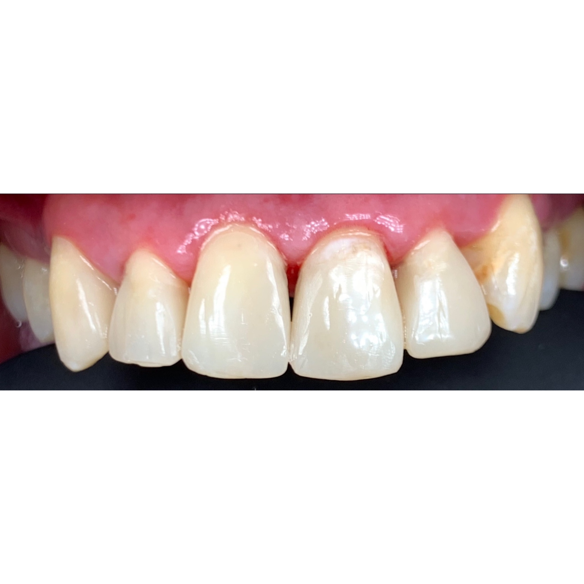 after smile makeover at Future of Dentistry